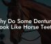 Why Do Some Dentures Look Like Horse Teeth